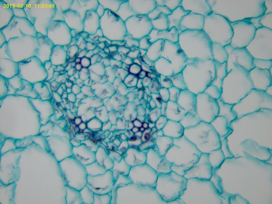 Typical dicot root,ranunculus mature root cs