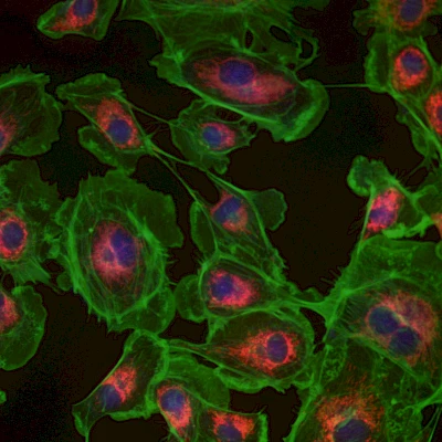 Fused Fluorescent Image