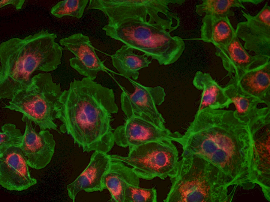 Fused Fluorescent Image
