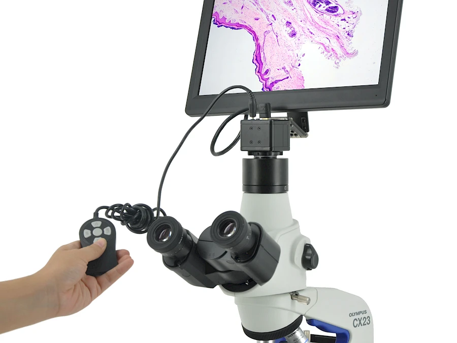 CE210 and its Microscope