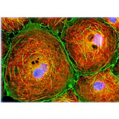 Fluorescent Observe