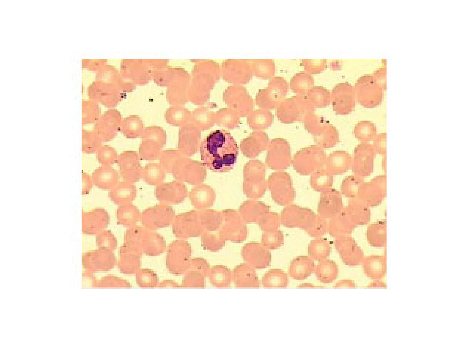 VMB200I 100X-400X Inverted Biological Microscope with Pendulum Rotate Condenser gallery image 7