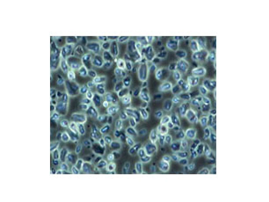 VMB200I 100X-400X Inverted Biological Microscope with Pendulum Rotate Condenser gallery image 9