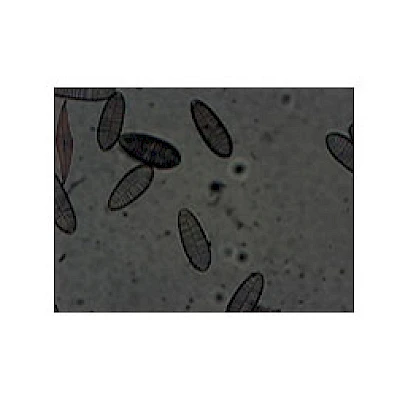 VMB300I 100X-400X Binocular Inverted Biological Microscope with Infinity Optical System image 9