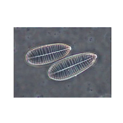 VMB300I 100X-400X Binocular Inverted Biological Microscope with Infinity Optical System image 10