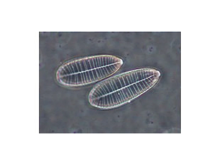VMB300I 100X-400X Binocular Inverted Biological Microscope with Infinity Optical System gallery image 10