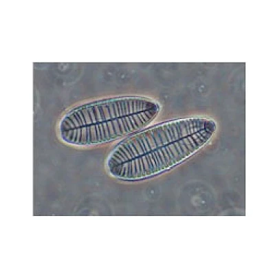 VMB300I 100X-400X Binocular Inverted Biological Microscope with Infinity Optical System image 11