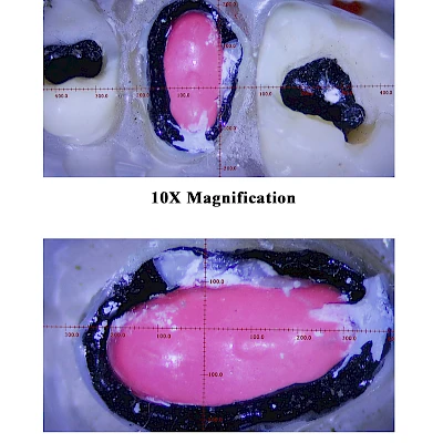 Captured Images of VMS103CD Dental Microscope