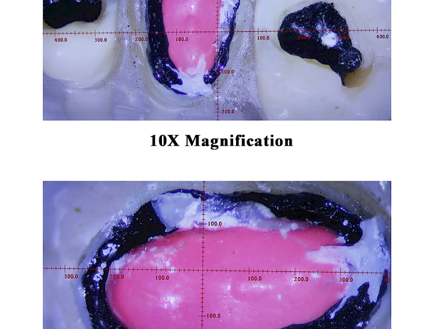 Captured Images of VMS103CD Dental Microscope