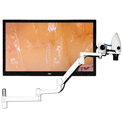 Real Picture Captured by VMS105CD Dental Microscope