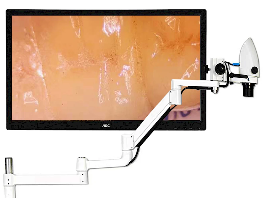 Real Picture Captured by VMS105CD Dental Microscope
