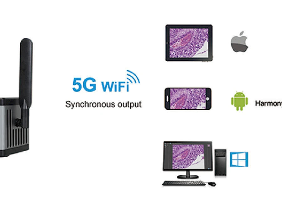 5G WIFI+ Network+ HDMI Simultaneous Output