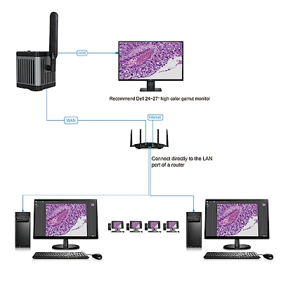 5G WIFI+ Network+ HDMI Simultaneous Output
