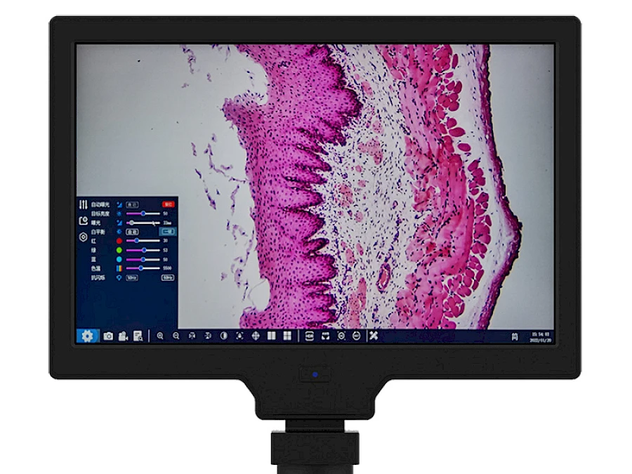 YW101 Microscope Monitor