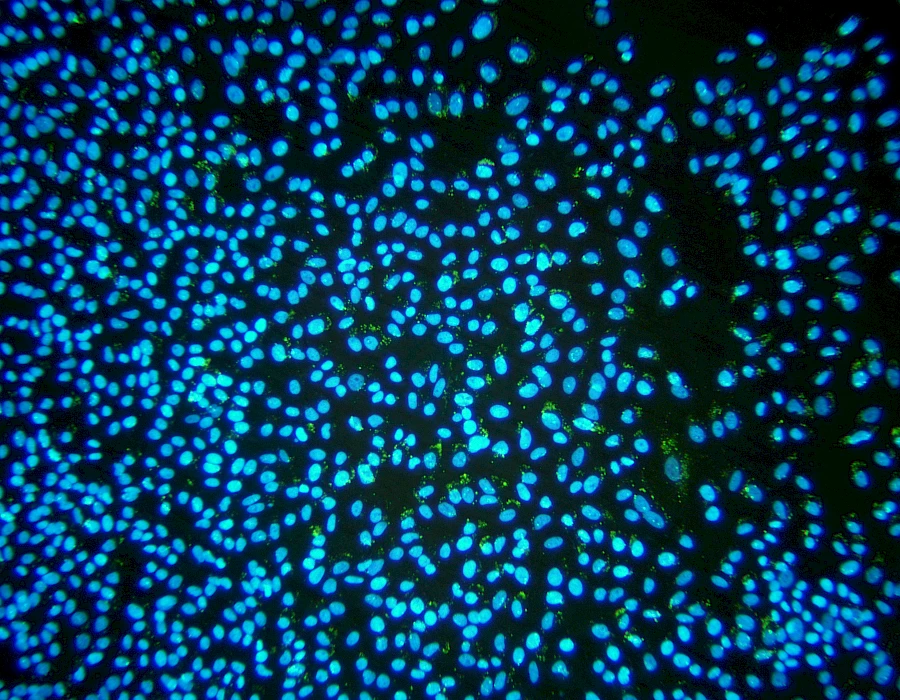 Images captured using the MTR3 series cooled camera and fluorescence microscopy system
