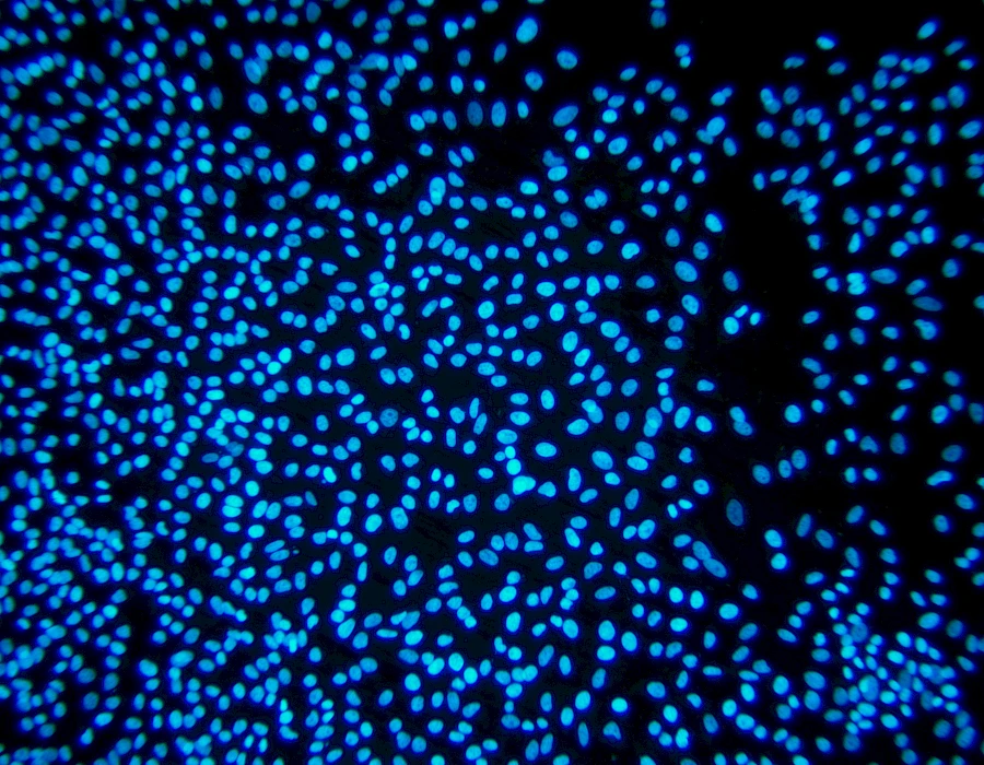 Images captured using the MTR3 series cooled camera and fluorescence microscopy system