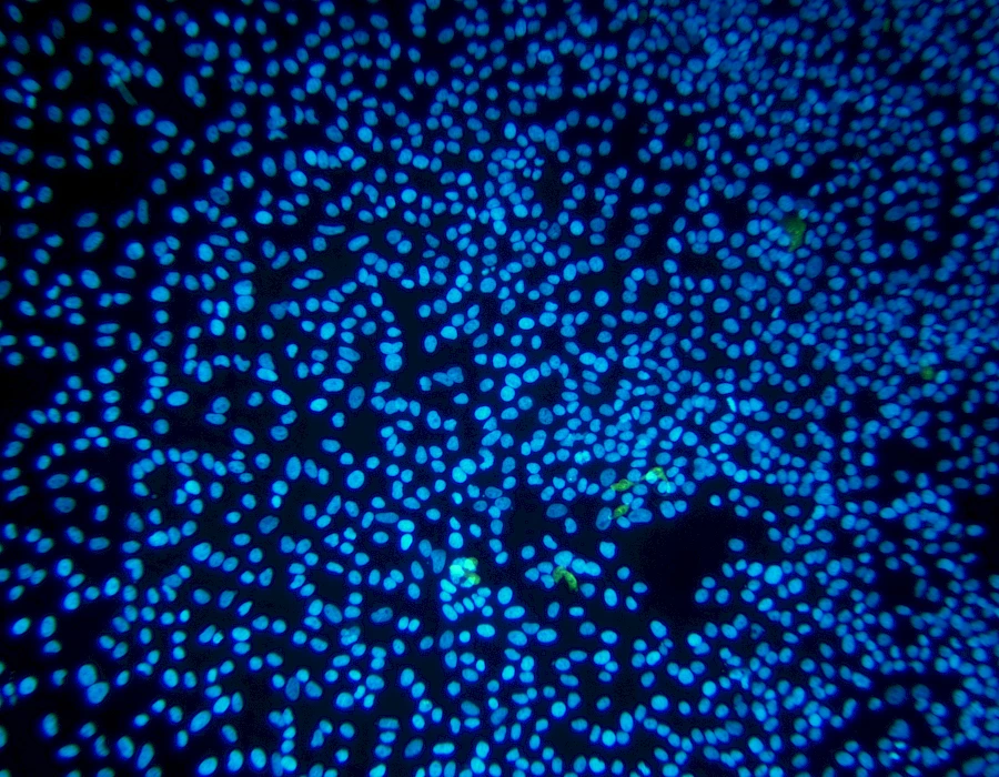 Images captured using the MTR3 series cooled camera and fluorescence microscopy system